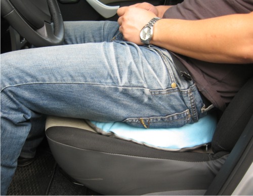 Hemoroizii pot fi tratați cu remedii din natură