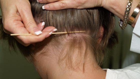 Păduchi la şcoala Pocruia