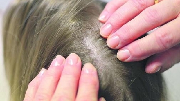 Elevi cu păduchi, în şcoli din Târgu-Jiu, Novaci şi Târgu-Cărbuneşti