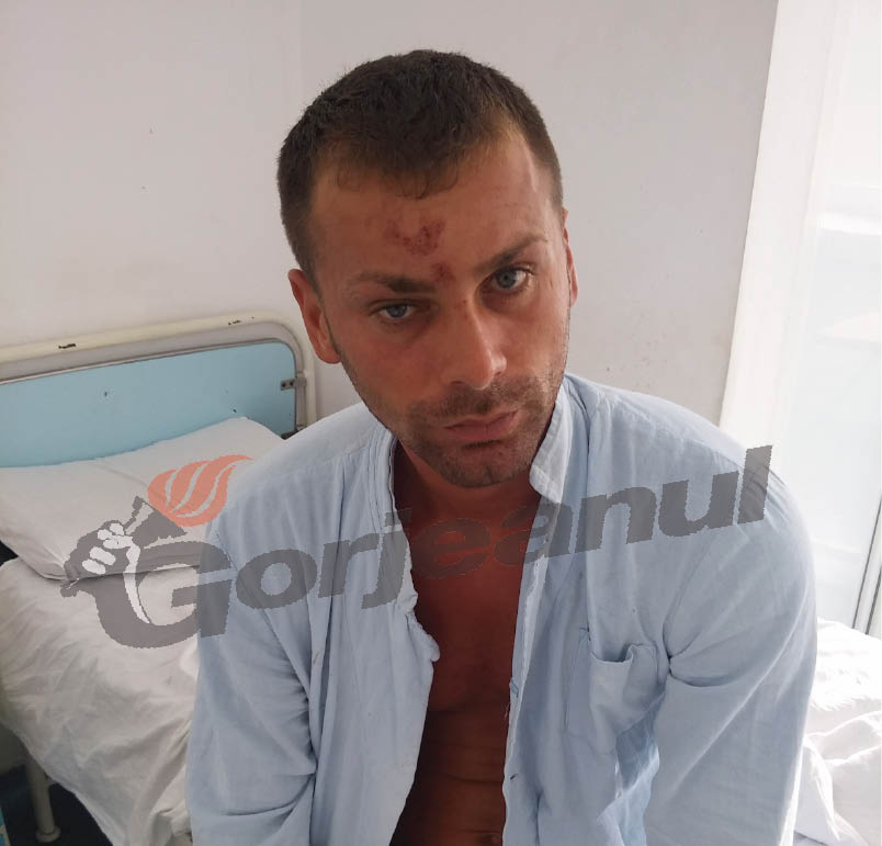 Bătut la Săcelu de indivizi necunoscuți