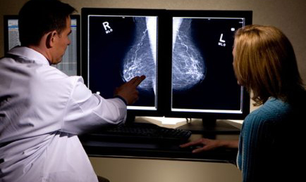 Peste 4.300 de gorjence, diagnosticate cu cancer la sân