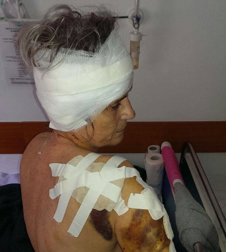 Poliția nu a luat nicio măsură în cazul profesoarei care a fost sfâșiată de câini