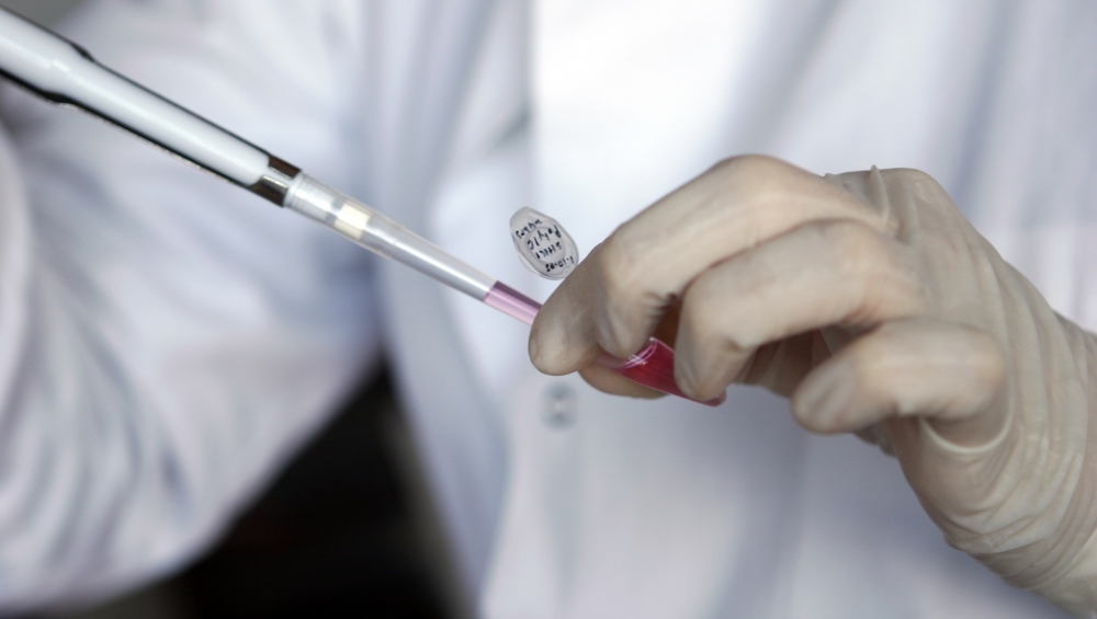 Teste Papanicolau gratuite pentru gorjence