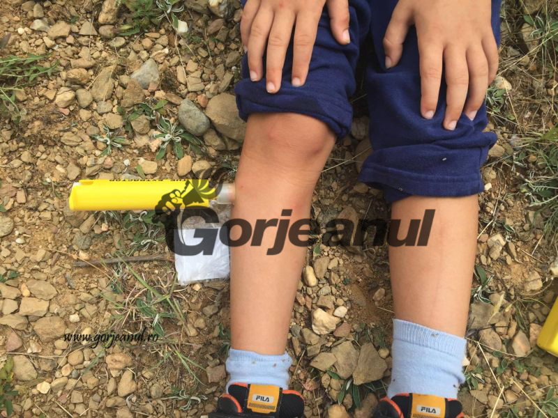 Salvamontiștii au salvat un minor din București, rănit pe Cheile Sohodolului