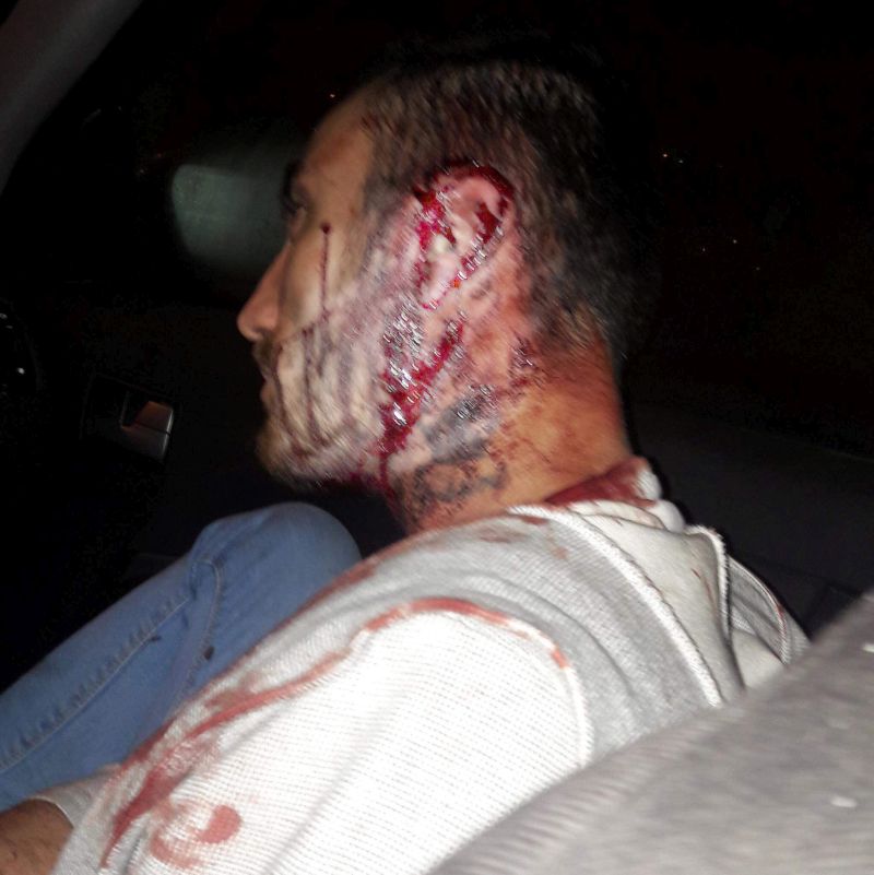 Lovit cu sticla în cap, în fața unui club din Peștișani