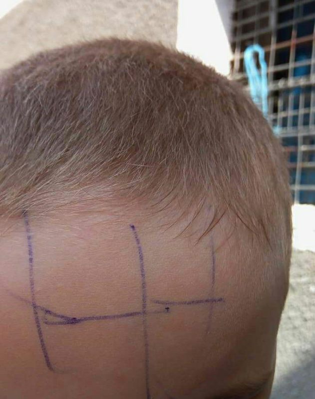 Anchetă la o grădiniță din Bustuchin! Educatoarea a scris cu pixul pe fruntea unui copil de patru ani