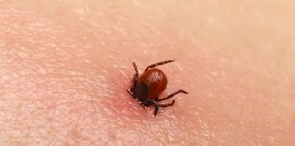 Primul ajutor în cazul înțepăturii de căpușă