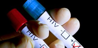 Indemnizații de hrană în valoare de 22.740 de lei pentru 48 de gorjeni cu HIV