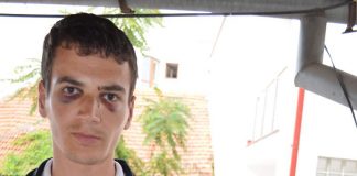 Bambilici, între ORL și Radiologia Spitalului “Tudor Vladimirescu” pentru diagnosticarea unei banale fracturi de piramidă nazală! Pacientul, luat la mișto, după ce a fost lovit de ruda unui polițist