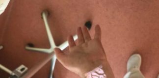 Spitalul Novaci s-a dotat cu un dispozitiv inteligent de vizualizare a venelor