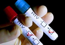 Indemnizații de hrană în valoare de aproximativ 23.00 de lei pentru 48 de gorjeni cu HIV