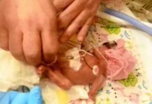 Ziua mondială a prematurităţii