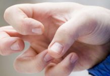 2180 de gorjeni suferă de epilepsie