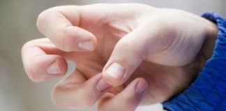 2180 de gorjeni suferă de epilepsie