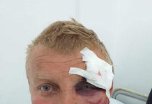 Șoferul primarului Drăgoescu, reținut 24 de ore pentru lovirea minerului de la EMC Roșia-Rovinari și favorizarea hoților de fier vechi!