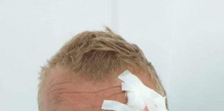 Lider de sindicat de la EMC Roșia-Rovinari, bătut în unitatea minieră de hoții de fier vechi! Minerul, la spital, hoții, audiați la poliție