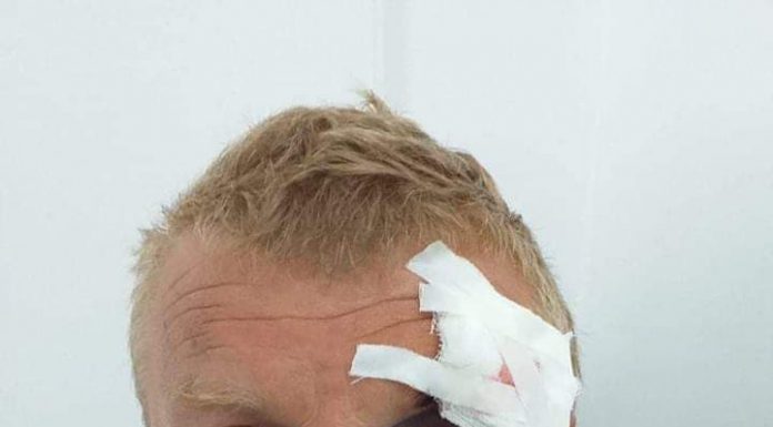 Lider de sindicat de la EMC Roșia-Rovinari, bătut în unitatea minieră de hoții de fier vechi! Minerul, la spital, hoții, audiați la poliție