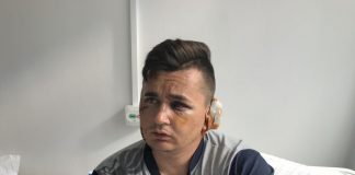 Bătuți în curtea Poliției Mătăsari! I-au rupt urechea!