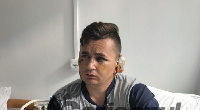 Bătuți în curtea Poliției Mătăsari! I-au rupt urechea!