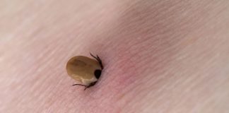 Gorjenii ajung zilnic la UPU Târgu-Jiu pentru înlăturarea căpușelor