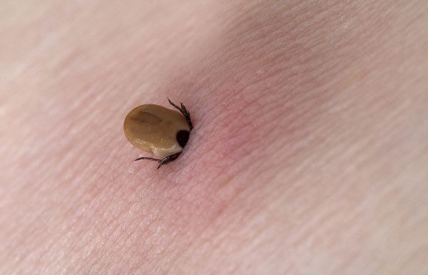 Gorjenii ajung zilnic la UPU Târgu-Jiu pentru înlăturarea căpușelor