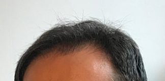 Dan Armeanu (ASF): Evoluție pozitivă a sistemului de pensii private în primul trimestrul al anului 2019