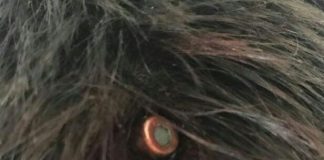 Starea de sănătate a tânărului lovit în cap de glonț este stabilă! Tragerile în poligon, sistate