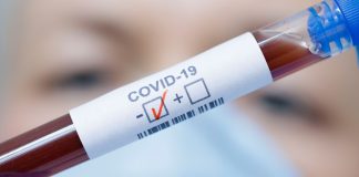 Vrea centre de testare pentru COVID-19 în fiecare județ