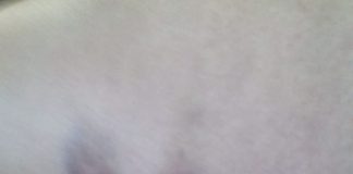 Și-a rupt două coaste, s-a umplut de vânătăi și și-a distrus bicicleta electrică din cauza unor câini din Turburea! Autoritățile au refuzat să o ajute