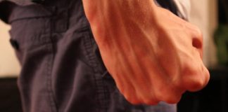 Femeie bătută de soțul gelos