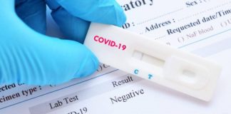 Testare națională pentru COVID-19