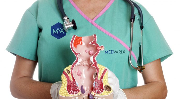 Hemoroizii si fisurile anale: ce sunt si cum se pot trata fara durere si operatie.