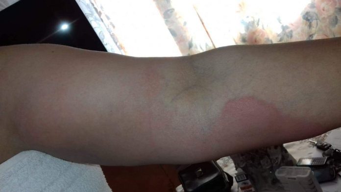 received_3169530069752519