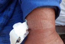 Bătaie de joc la adresa unui pacient septuagenar, internat la Dobrița dar transferat în Spitalul COVID! Bolnavul dus la o cură de oxigen, acum în stare critică