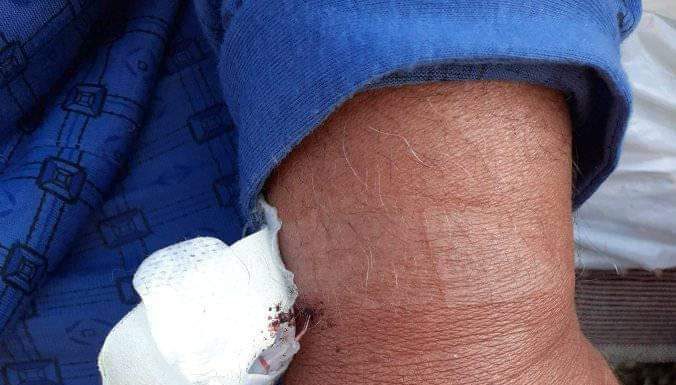 Bătaie de joc la adresa unui pacient septuagenar, internat la Dobrița dar transferat în Spitalul COVID! Bolnavul dus la o cură de oxigen, acum în stare critică