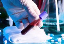 Puține cazuri de Covid, teste la fel de puține