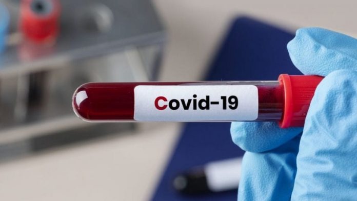 COVID-19-blood-test-1280x720