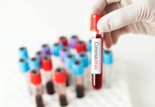 Record! Aproape 20.000 de cazuri noi de Covid