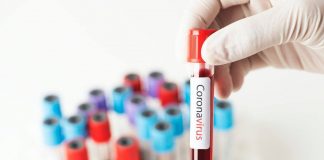 Cumpără mașină de 50.000 de lei pentru transportul probelor Covid