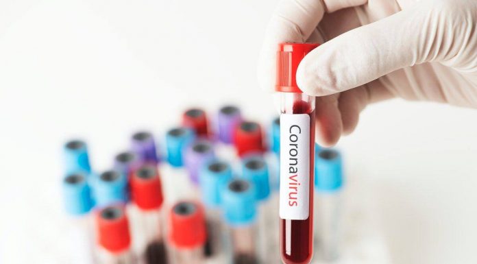 1059 de noi cazuri de COVID-19, în România