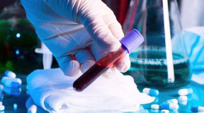 Șase cazuri de Covid în Gorj