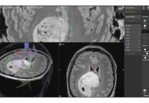 Compartiment de Neurochirurgie la SJU Târgu Jiu
