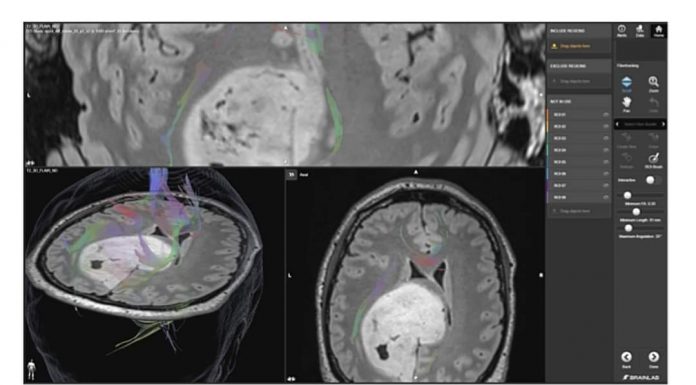 Compartiment de Neurochirurgie la SJU Târgu Jiu