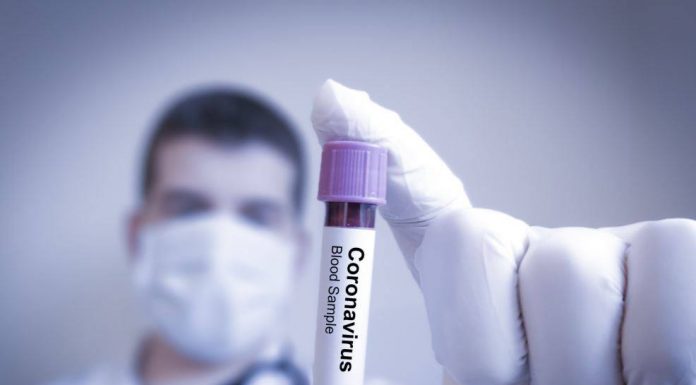 Un deces și cinci cazuri noi de Covid