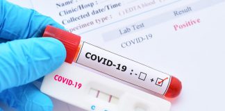 Vaccin anti-COVID-19 în 20 de centre din Gorj