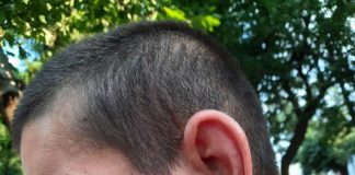 Bătut de polițiști și jandarmi. Urma bocancului – pe fața victimei!