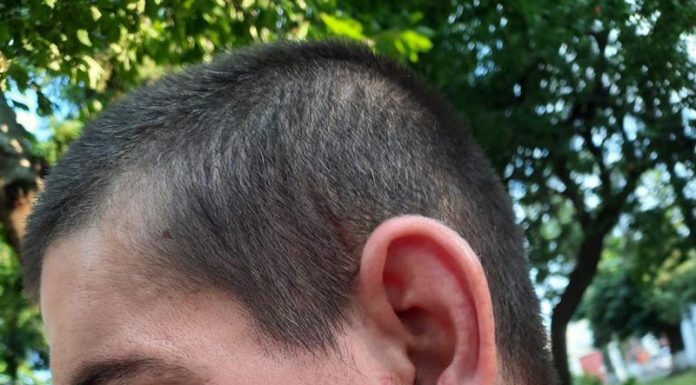 Bătut de polițiști și jandarmi. Urma bocancului – pe fața victimei!