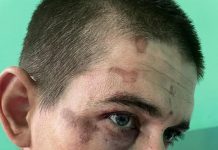 Trei jandarmi și trei polițiști, acuzați că au stâlcit în bătaie un bărbat din Țicleni!