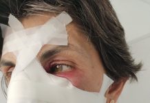 Vărul lui Dan Vîlceanu, cu dosar penal după ce ar fi desfigurat o femeie