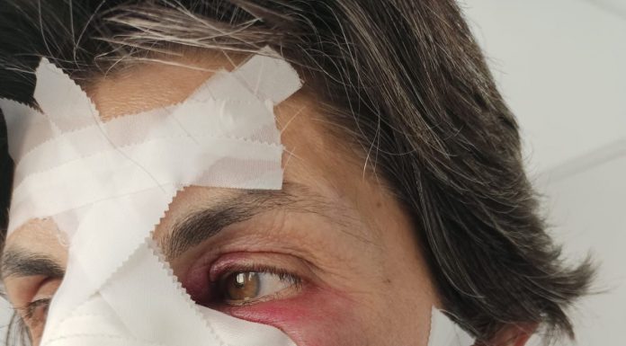 Vărul lui Dan Vîlceanu, cu dosar penal după ce ar fi desfigurat o femeie